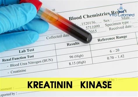 This medicine is available only with your doctor's prescription. . Creatinine mayo clinic